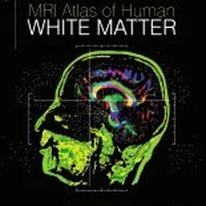 MRI Atlas of Human White Matter
