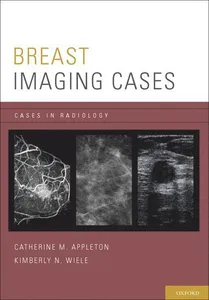 Breast Imaging Cases