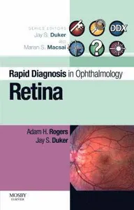 Rapid Diagnosis in Ophthalmology Series: Retina