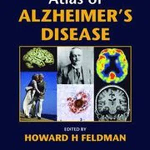 Atlas of Alzheimer's Disease