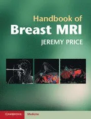 Handbook of Breast MRI
