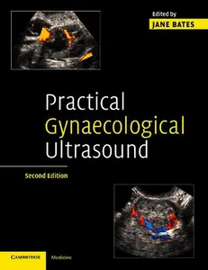 Practical Gynaecological Ultrasound