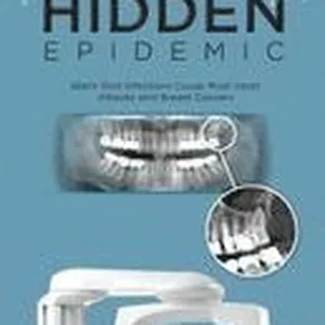 Hidden Epidemic: Silent Oral Infections Cause Most Heart Attacks and Breast Cancers
