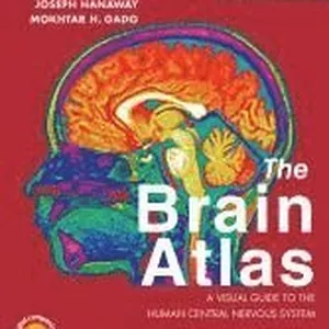 Brain Atlas