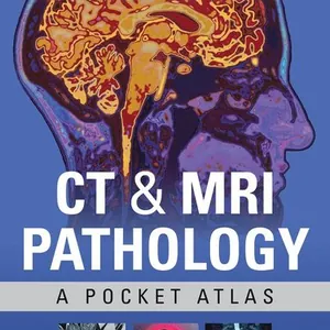 CT & MRI Pathology: A Pocket Atlas, Third Edition