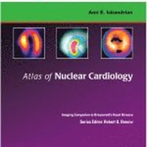 Atlas of Nuclear Cardiology: Imaging Companion to Braunwald's Heart Disease