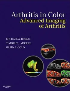 Arthritis in Color