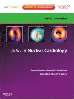 Atlas of Nuclear Cardiology: Imaging Companion to Braunwald's Heart Disease