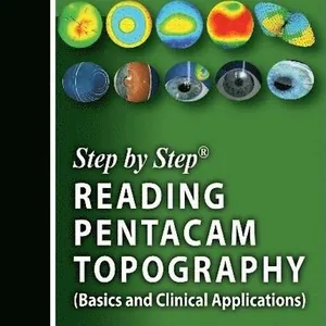 Step by Step: Reading Pentacam Topography
