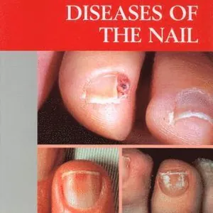 Atlas of Diseases of the Nail