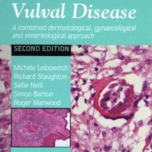 Atlas of Vulval Diseases