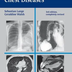 Radiology of Chest Diseases