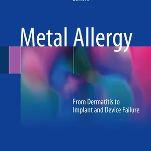 Metal Allergy