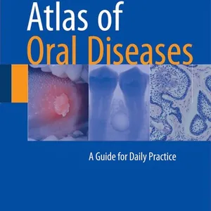 Atlas of Oral Diseases