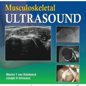 Musculoskeletal Ultrasound