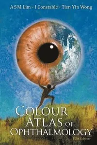 Colour Atlas Of Ophthalmology (Fifth Edition)